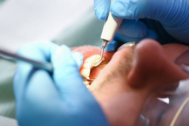 Best After-Hours Emergency Dentist in Dunkirk, IN