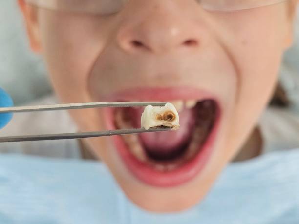 Professional Emergency Dentist in IN