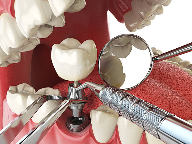 Best Emergency Orthodontic Repairs in Dunkirk, IN